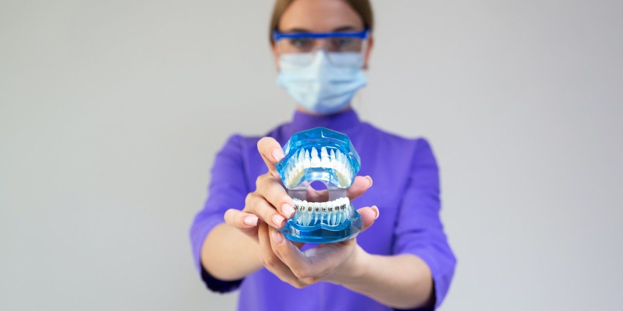 How to Prepare for Dental Implants