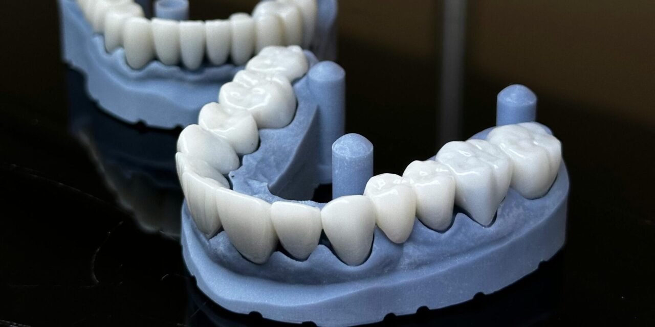 Long-term care tips to extend implant lifespan
