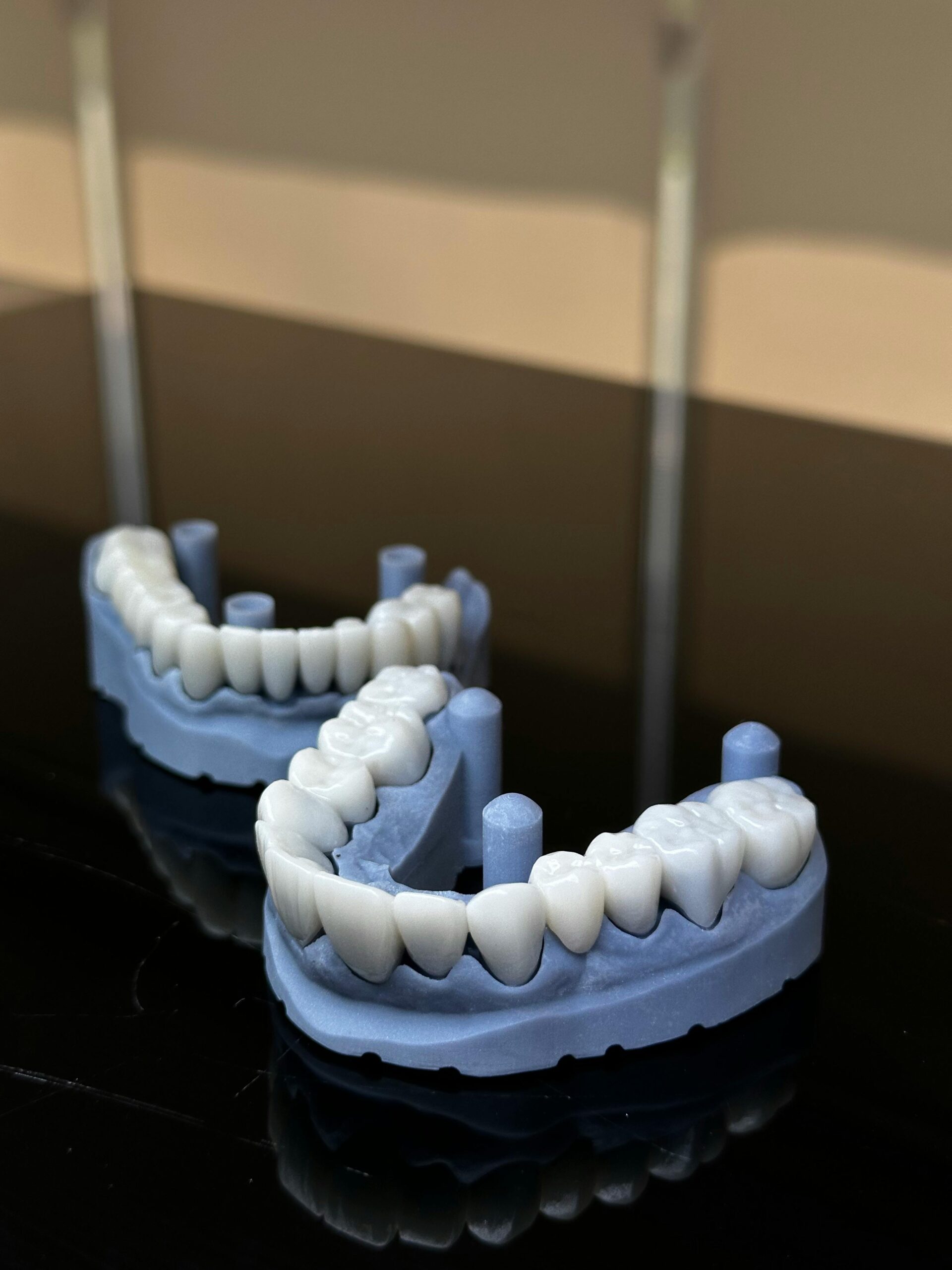 Long-term care tips to extend implant lifespan